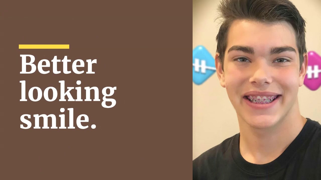 Metal Braces Georgetown (512) 887-1610 orthodontist specialist