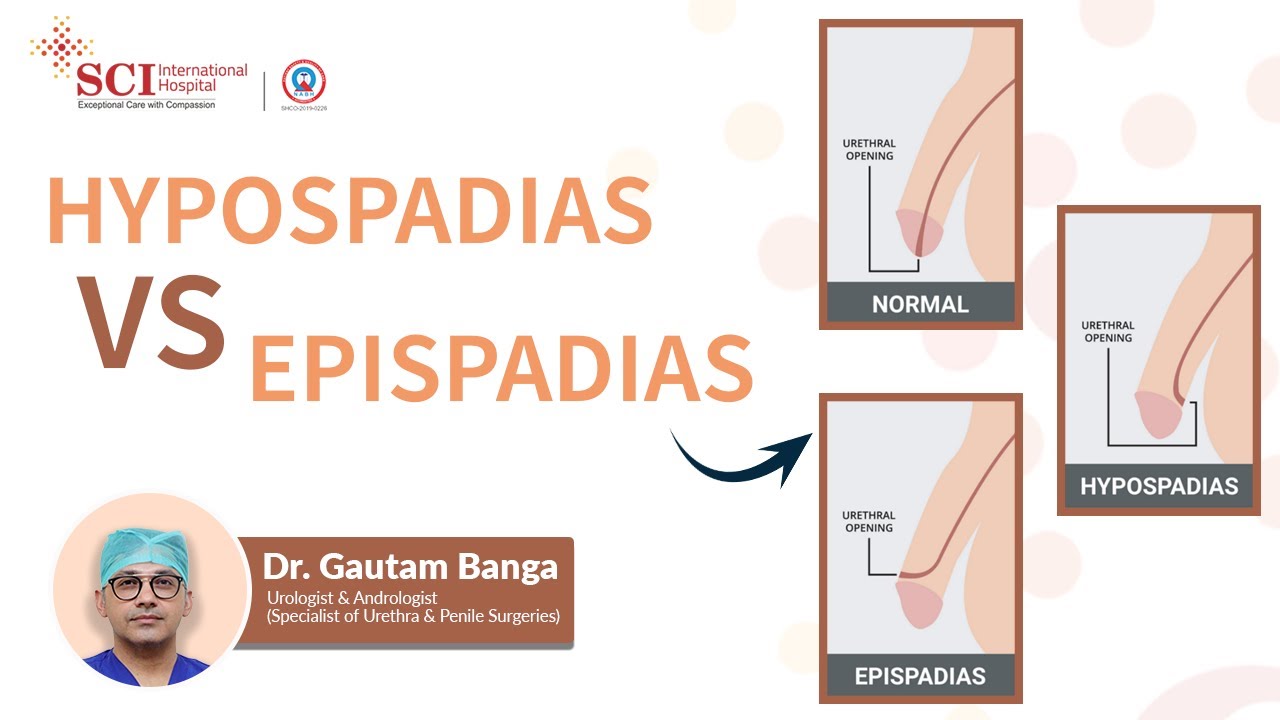 Hypospadias vs Epispadias | Dr. Gautam Banga | SCI Hospital