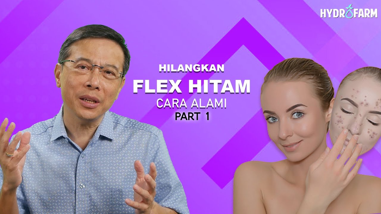 Hilangkan Flex Hitam cara Alami Part 1