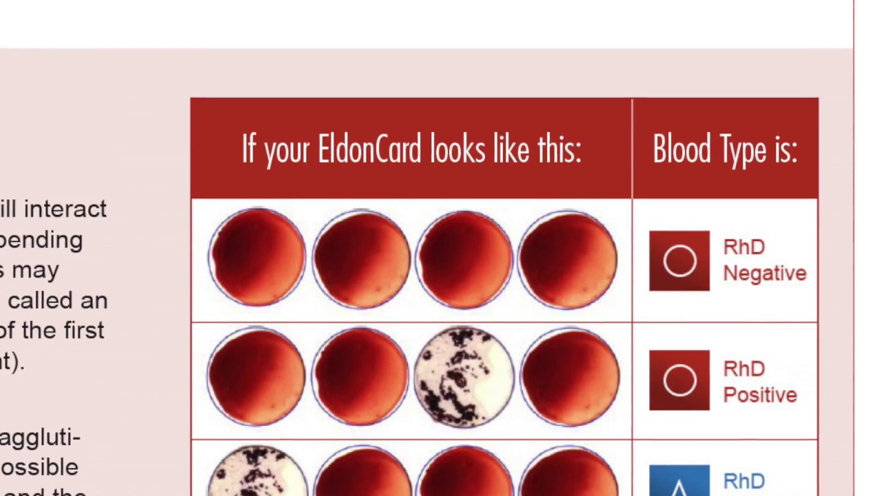 Home Blood Typing Kit Tutorial