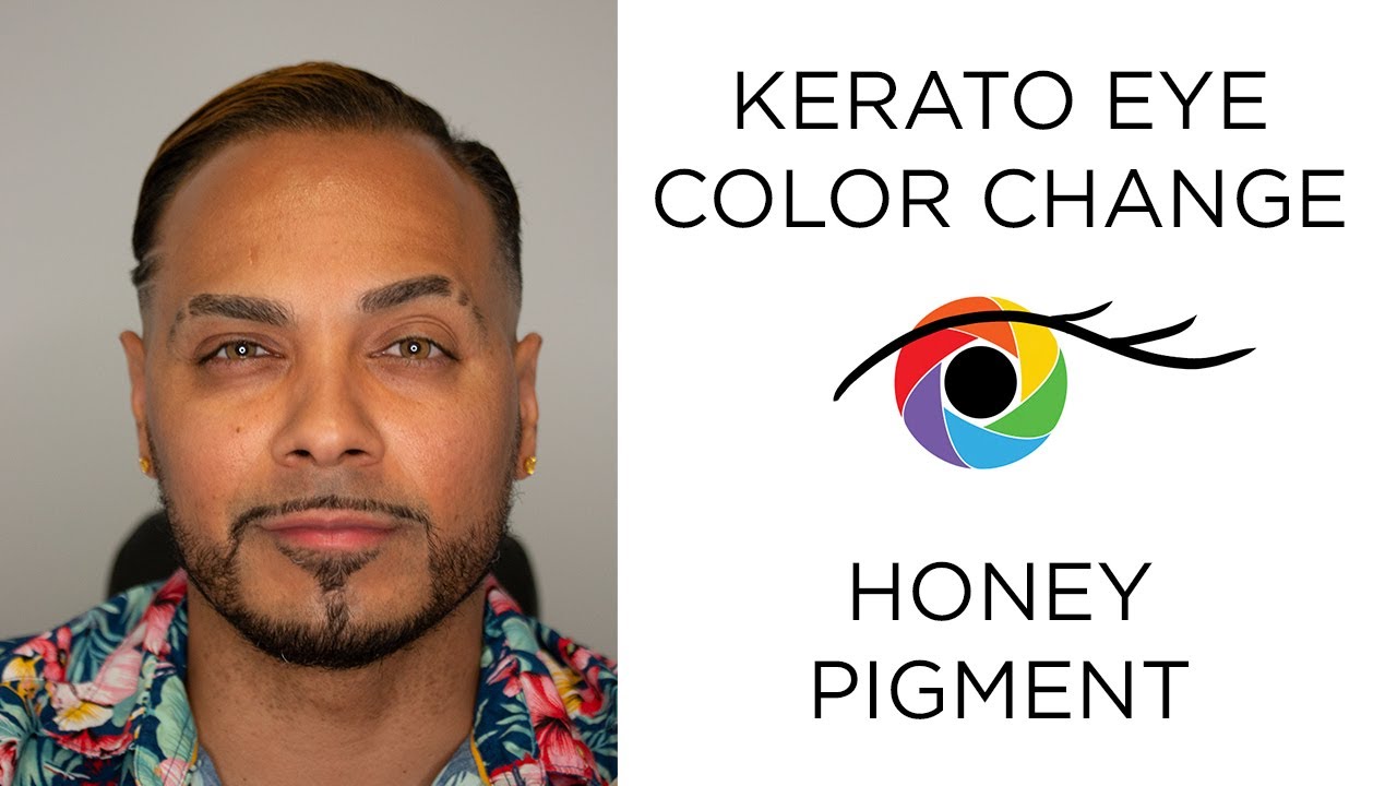 Eye Color Change From Dark Brown to Light Brown with Kerato