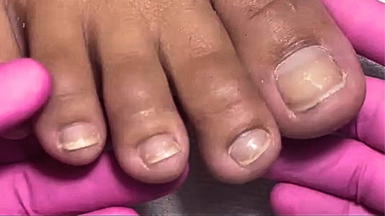 Segredo das Cutículas Bem Feitas nos Pés: Aprenda em 5 Minutos