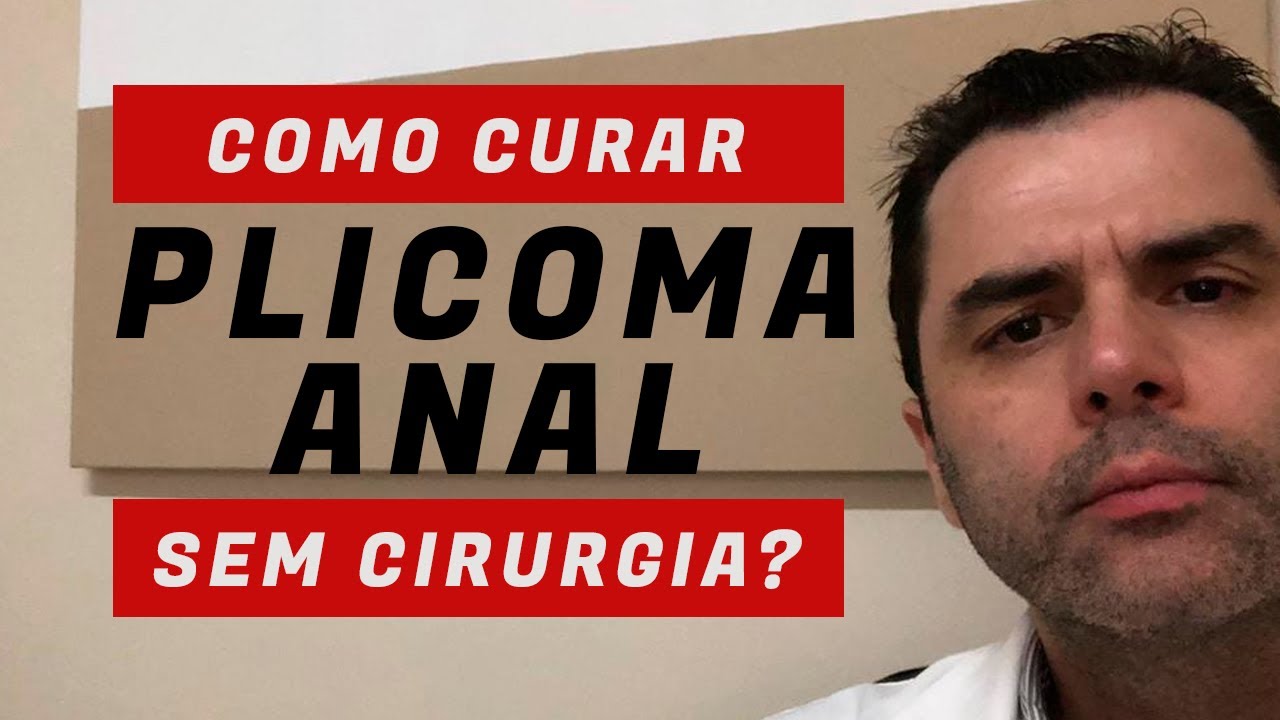 👨‍⚕️ Como curar Plicoma Anal sem Cirurgia?