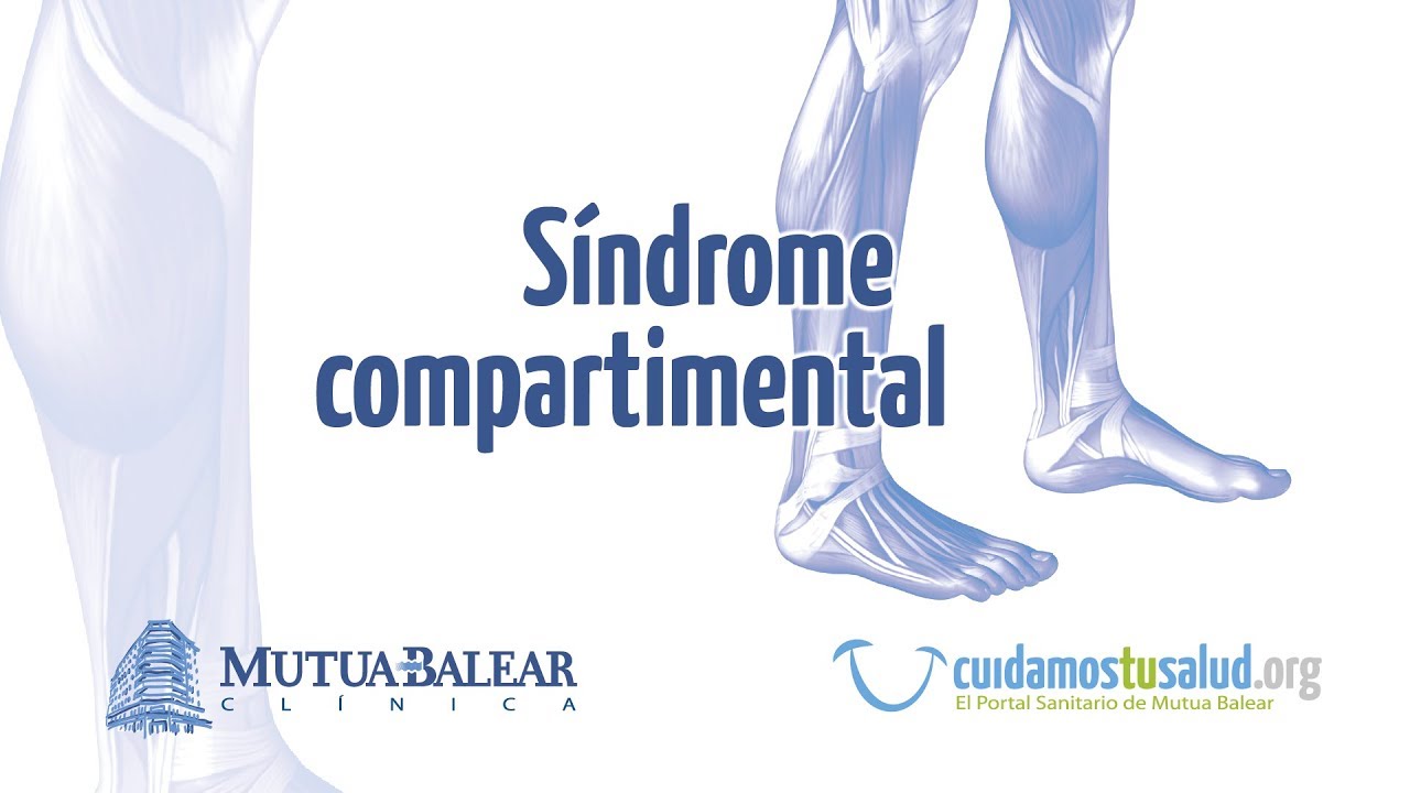 PROTOCOLO DE DETECCI&Oacute;N PRECOZ DEL S&Iacute;NDROME COMPARTIMENTAL