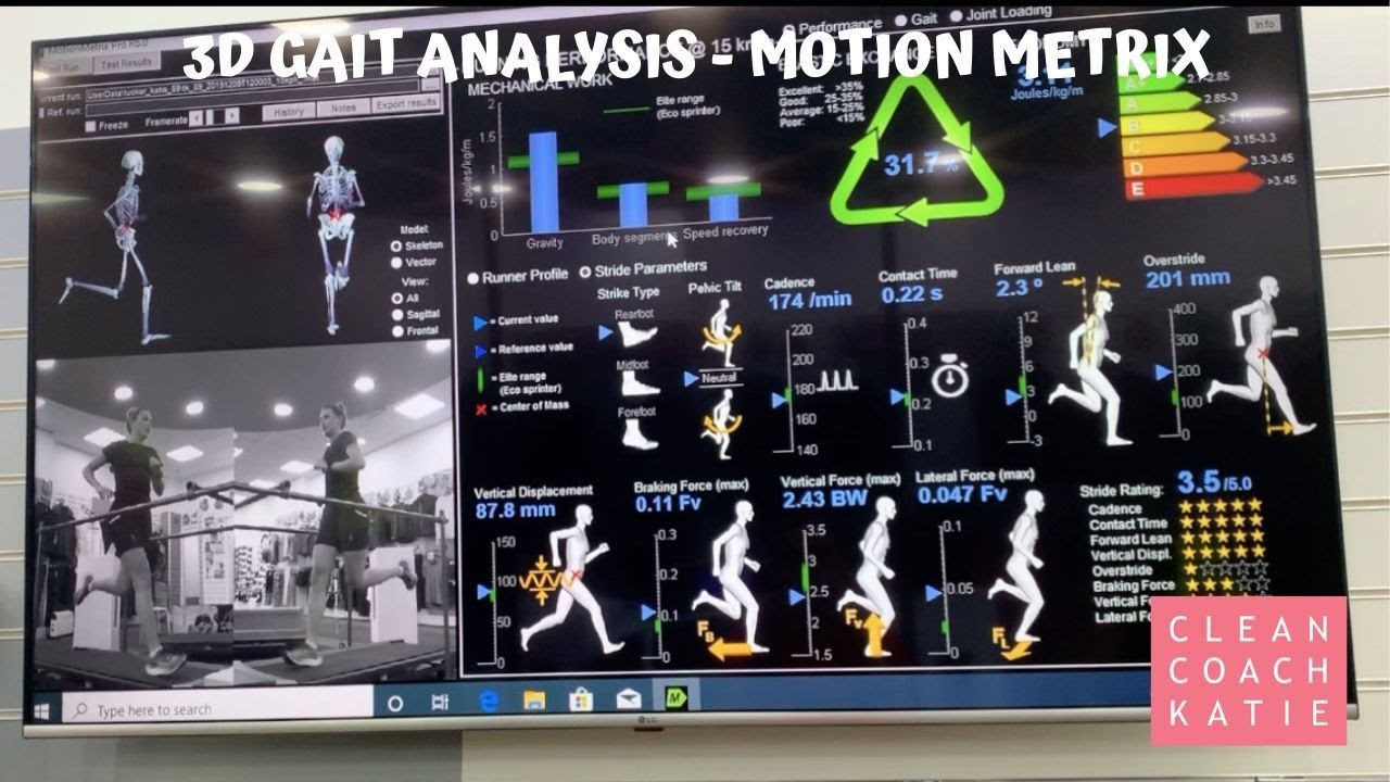 3D Gait Analysis (Motion Matrix) at Up & Running Milton Keynes