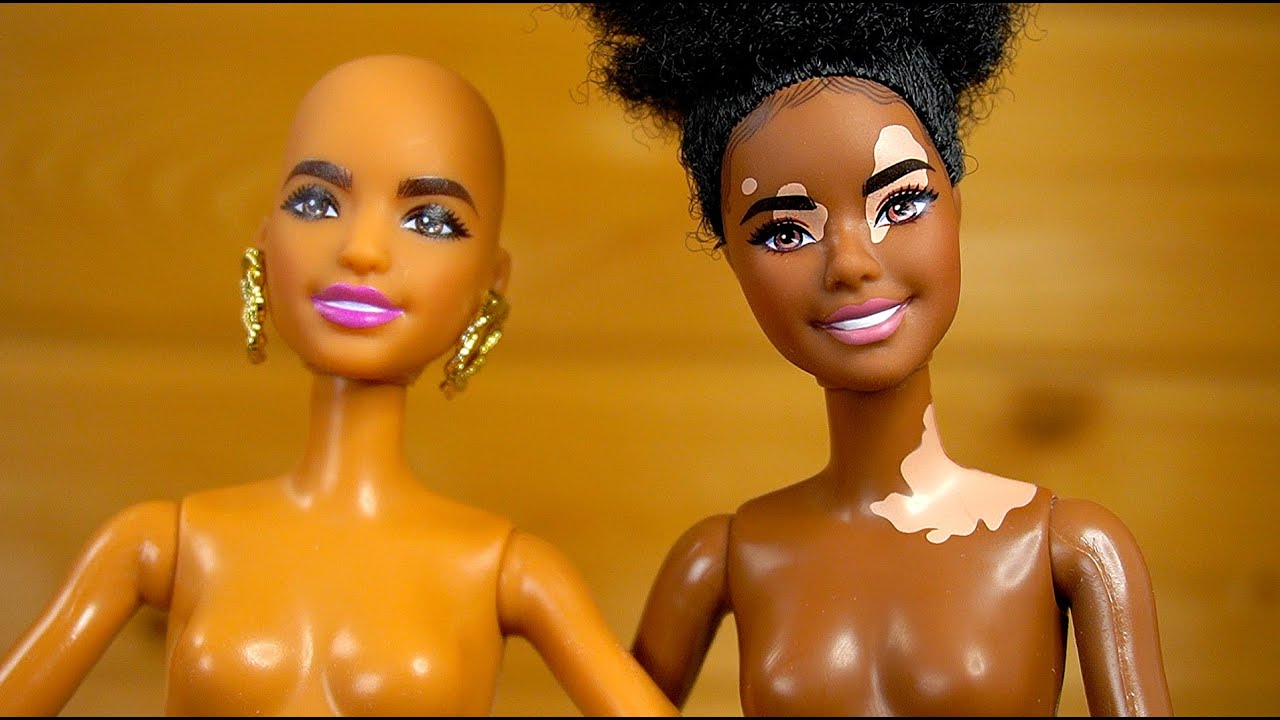 Витилиго и Лысая Барби Fashionistas