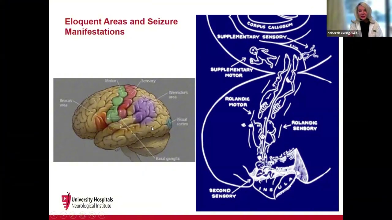 2025.01.07 - CWRU SMGR: Dr. Deborah Ewing-Wilson - Sleep and Epilepsy