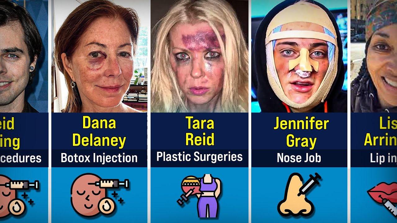 20 Hollywood Celebrities who RUINED their careers with PLASTIC SURGERY