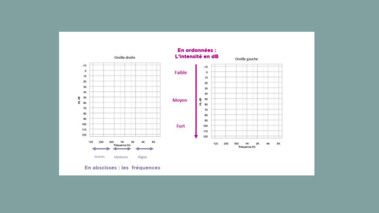 comment faire une audiogramme