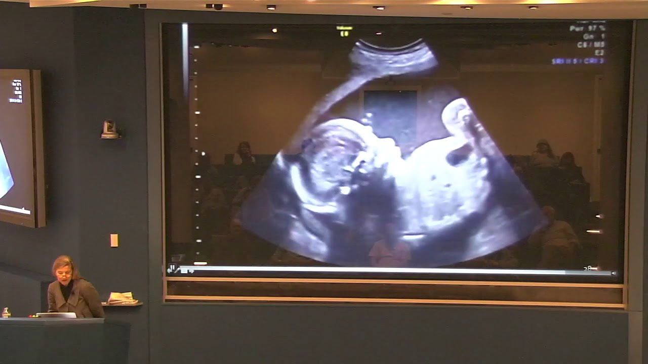 Catherine Monk - Development Begins Before Birth (March 30, 2016)