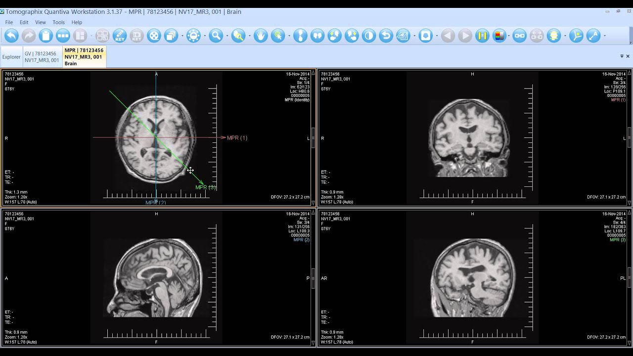Quantiva | MPR - Multiplanar Reconstruction