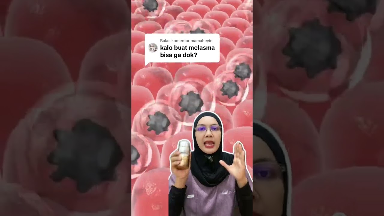 Cysteamine bisa ya untuk melasma