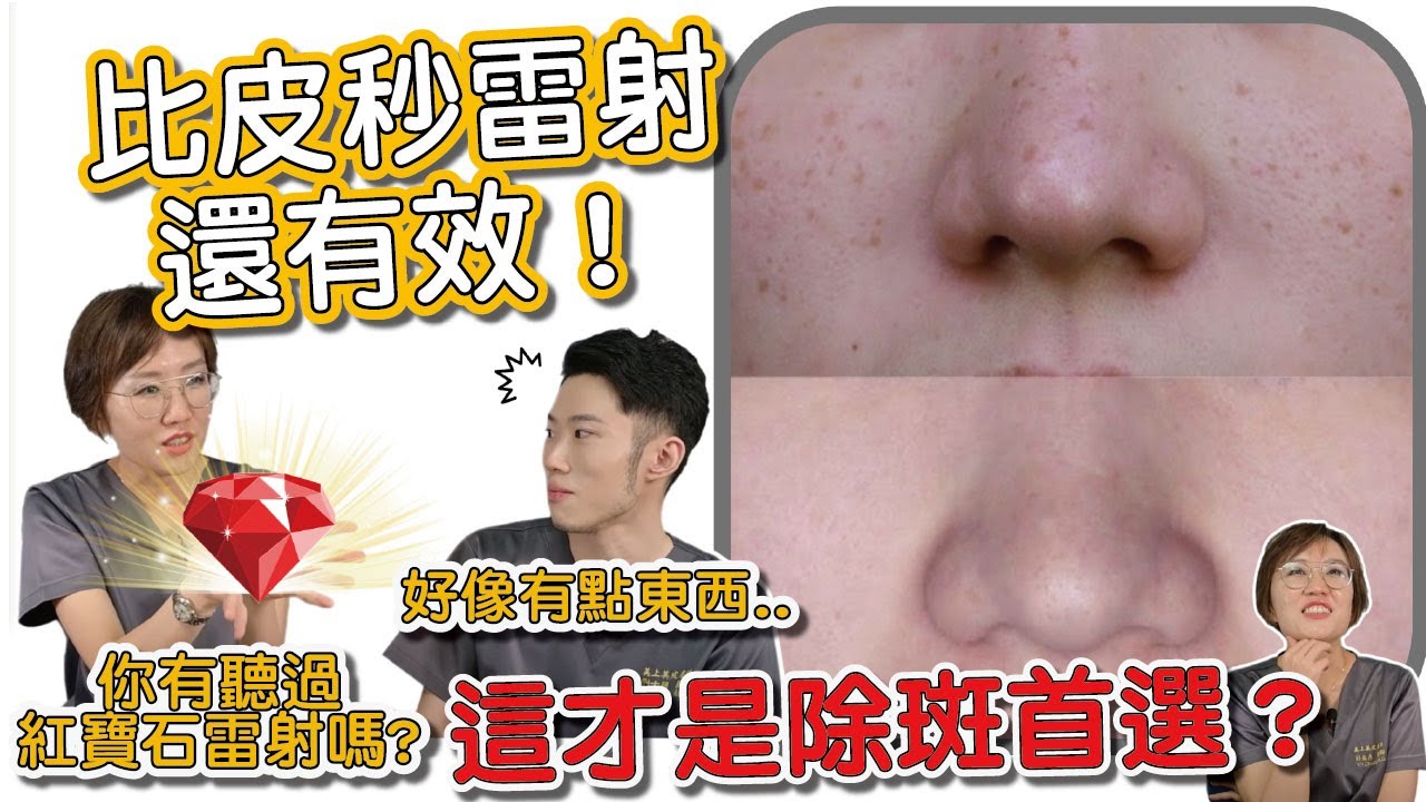跟臉上斑點說掰掰！皮膚科醫生愛用的除斑雷射：紅寶石雷射！