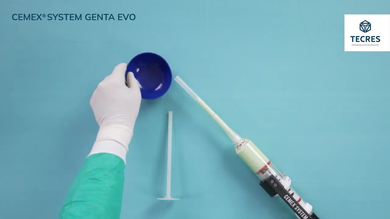 Cemex® System EVO  the latest evolution of the closed cementation system