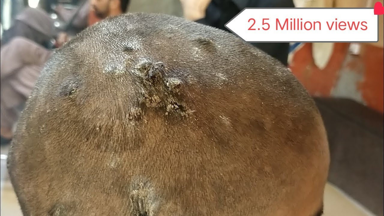 Headshave| Head massage | head massager reaction | Head shave hair regrowth | by Mujahid salon