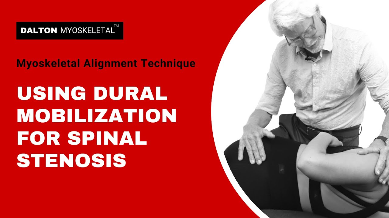 Using Dural Mobilization for Spinal Stenosis | ErikDalton.com