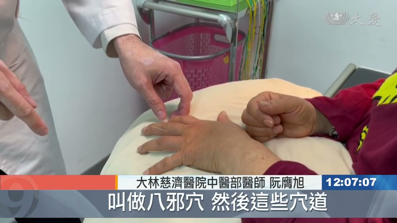 也是文明病！扳機指有望改善？