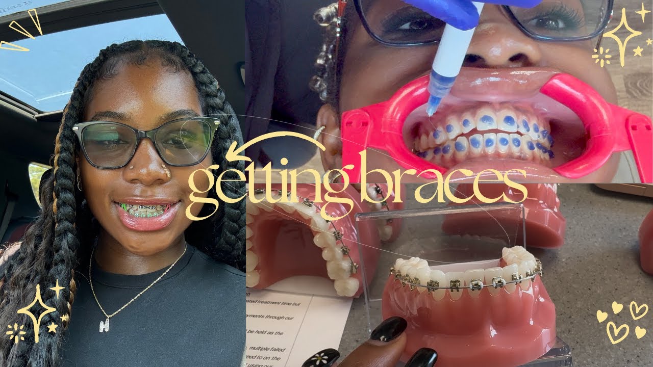 I impulsively got BRACES!! (real & raw vlog)