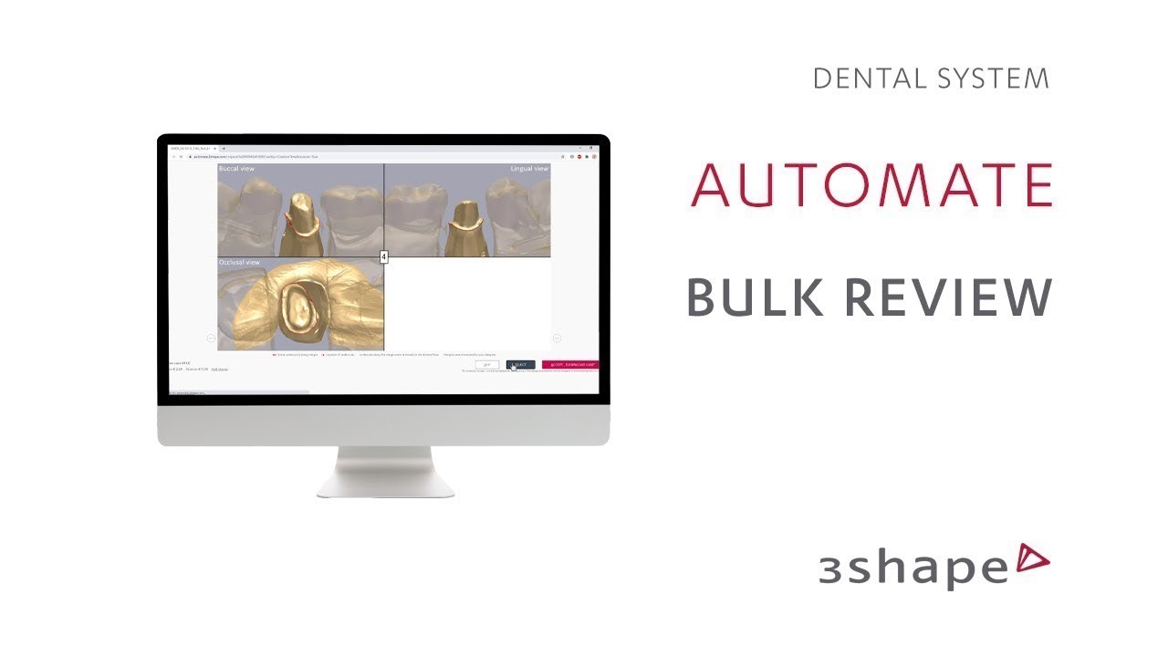 3Shape Automate –  Using bulk review