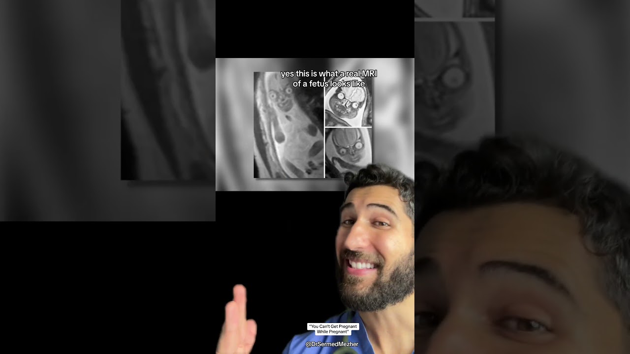 &ldquo;You Can&rsquo;t Get Pregnant While Pregnant&rdquo; #wait