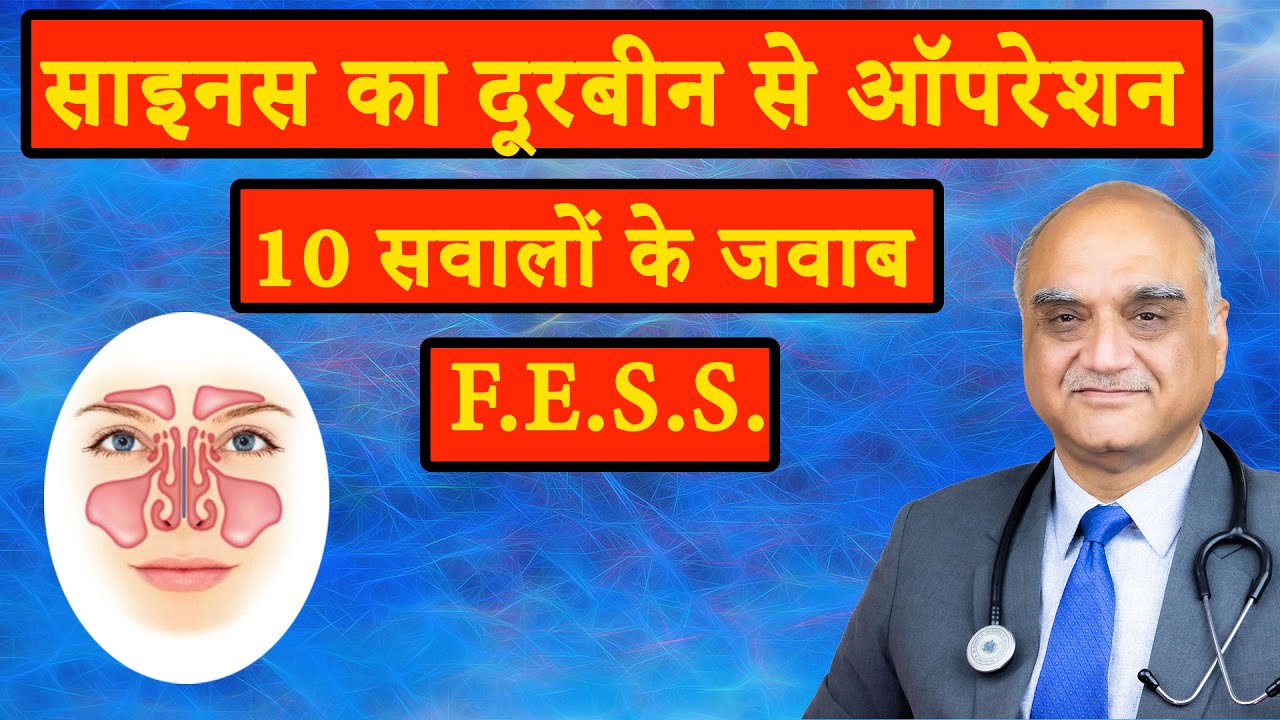 Sinusitis surgery। # FESS । साइनस के लिए ऑपरेशन। Hindi। Dr Rajive Bhatia