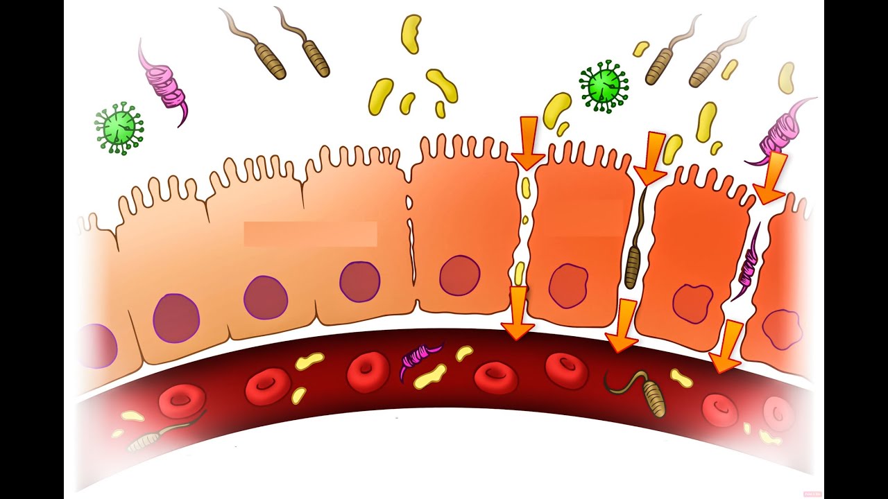 CURA LA PERMEABILIDAD INTESTINAL HACIENDO ESTO (Y FRENA EL ENVEJECIMIENTO PREMATURO)
