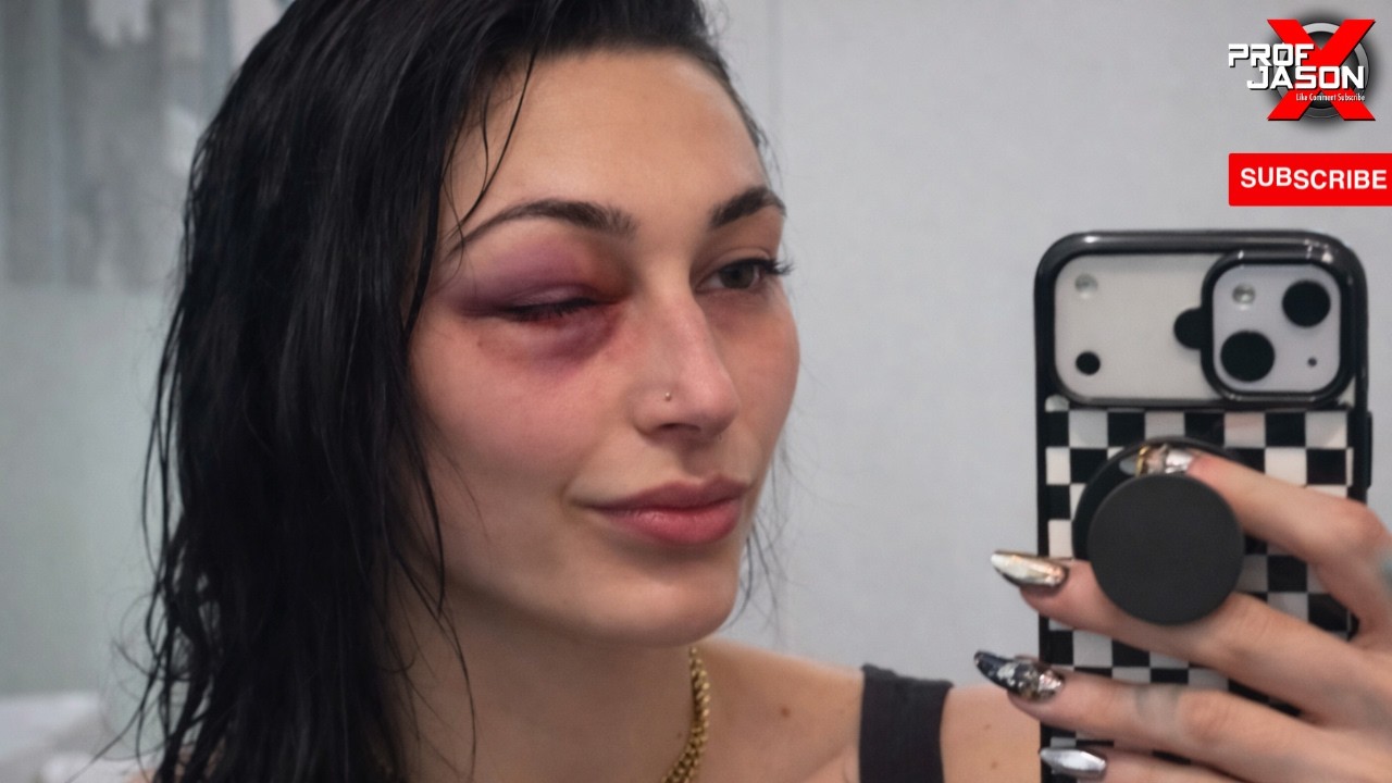 RHEA RIPLEY INJURED IN THE FACE AGAIN! GIULIA FRUSTRATED WITH WWE!