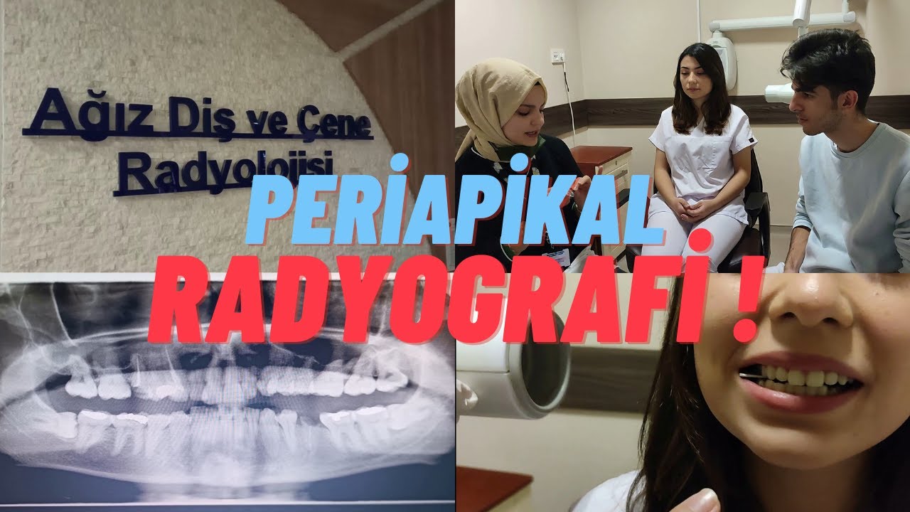 PERİAPİKAL FİLM NASIL ÇEKİLİR?/PERİAPİCAL RADİOGRAPHY/PANAROMİK FİLM/oral diagnoz stajına hoşgeldin!