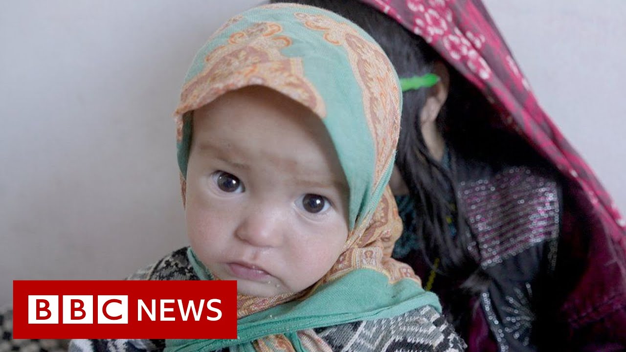 Afghan children battle malnutrition and measles as 23m face extreme hunger - BBC News