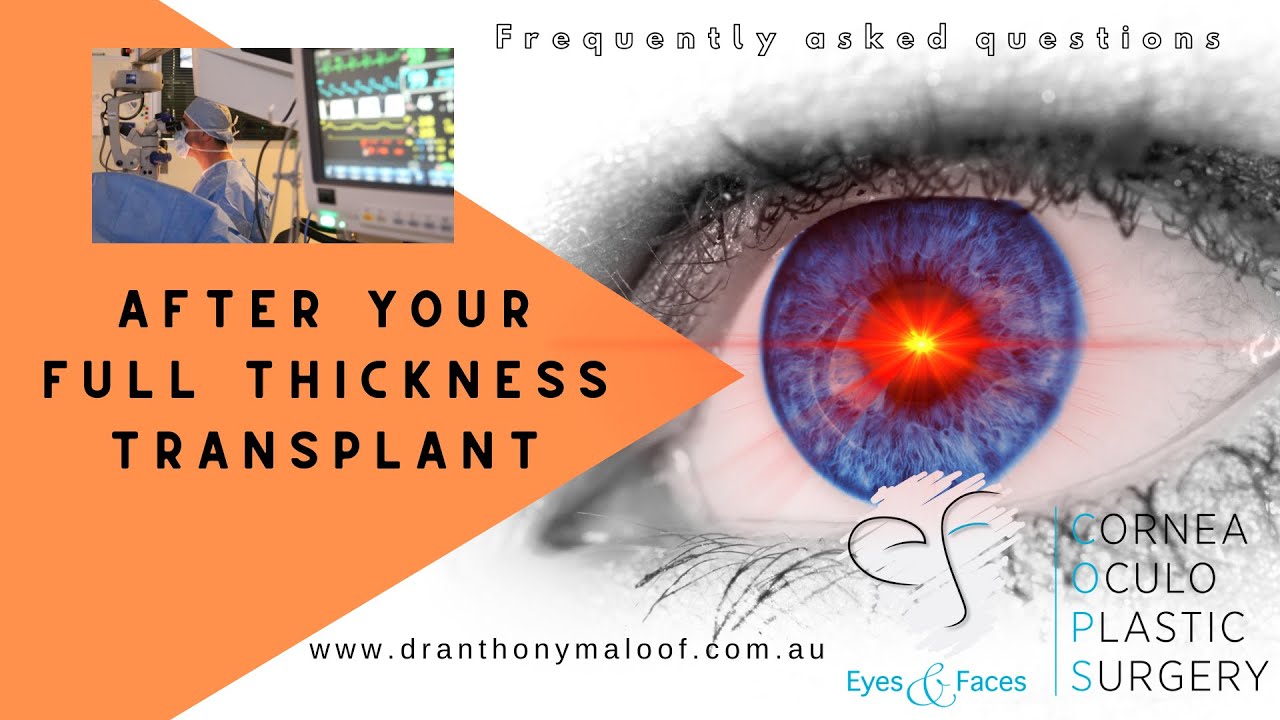 After your Surgery  - After your full thickness transplant - Dr Anthony Maloof, Sydney