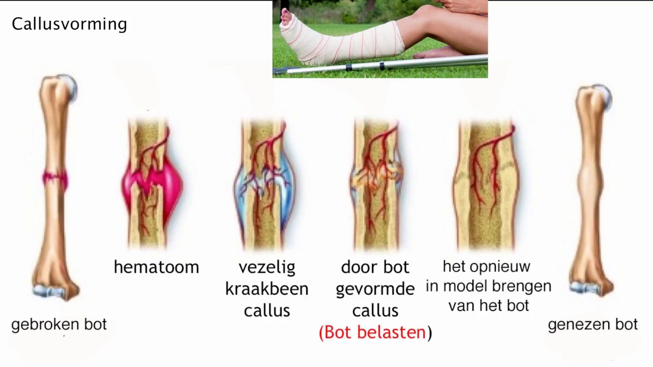 Lengte en breedtegroei van de botten en callusvorming