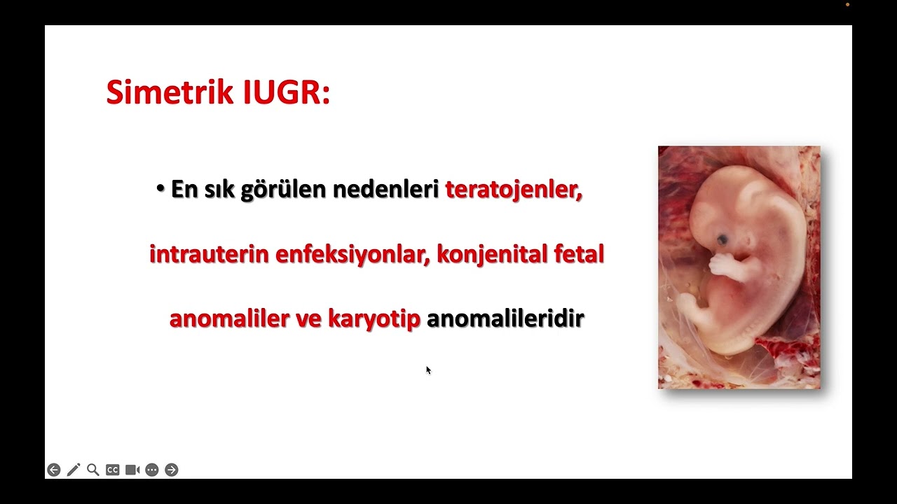2023 Eylül TUS soruları yorumlar