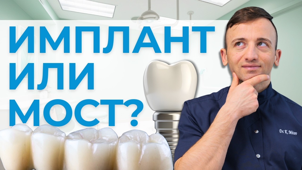 Имплант или мост - кое е по-доброто решение?