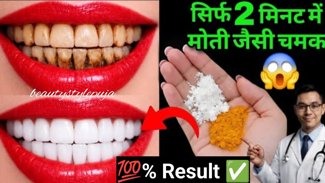 सिर्फ 10 रु में गंदे पीले दांतों को मोती की तरह चमका देगा✅Teeth Whitening Remady👉How to Whiten teeth
