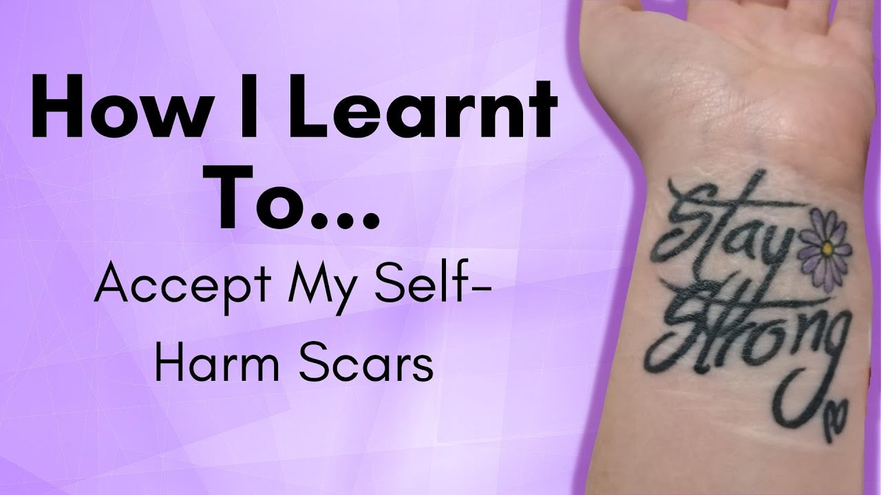 How I Accepted My Self Harm Scars