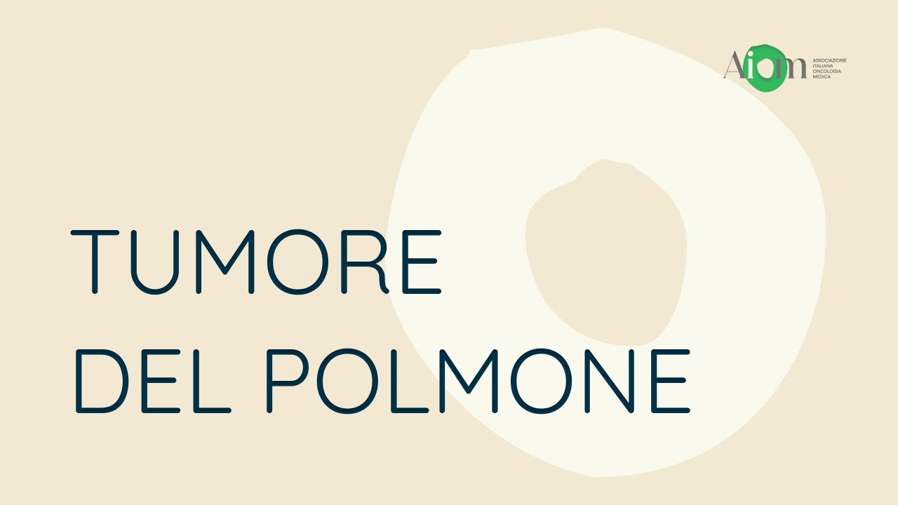 Carcinoma polmonare: le novità emerse all'ASCO23 | Silvia Novello