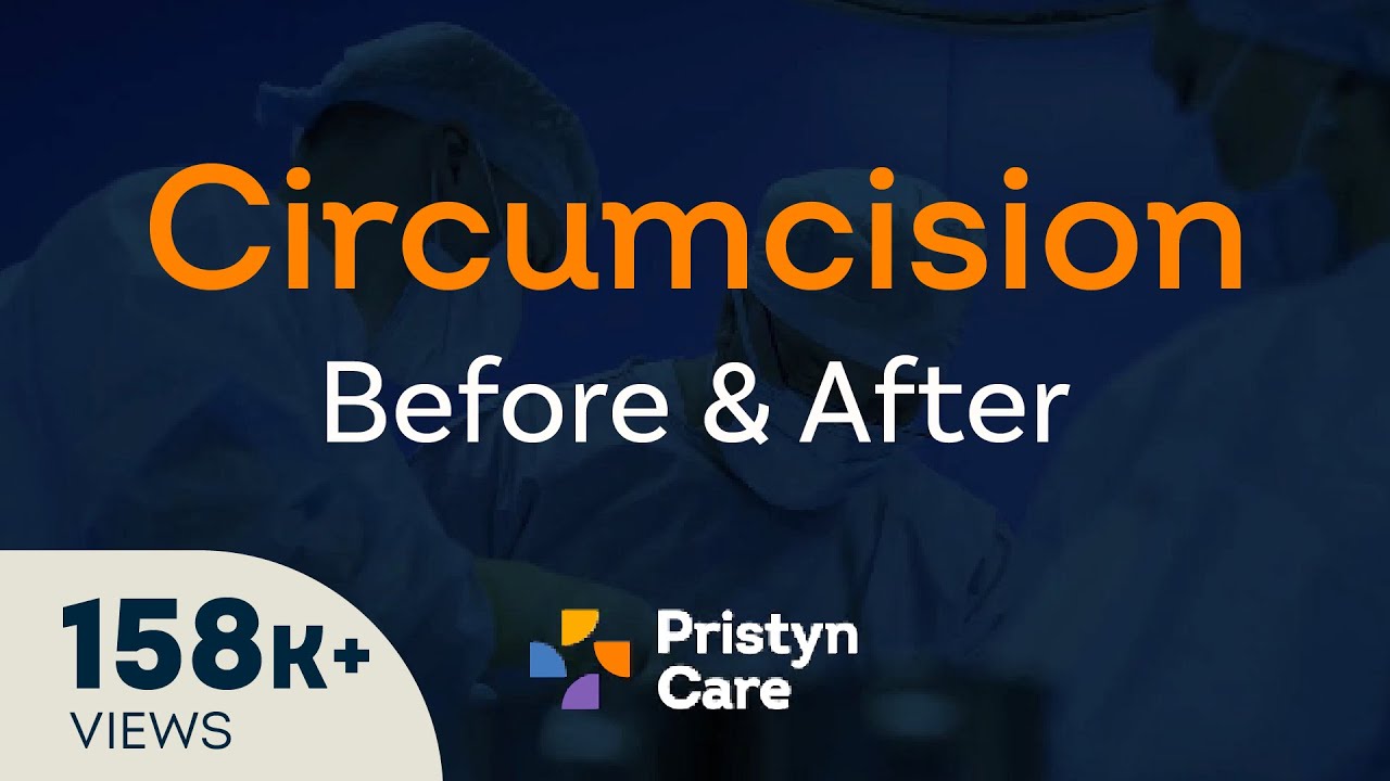 Before v/s After Laser Circumcision Surgery - For FREE Consultation Call On 08065417725