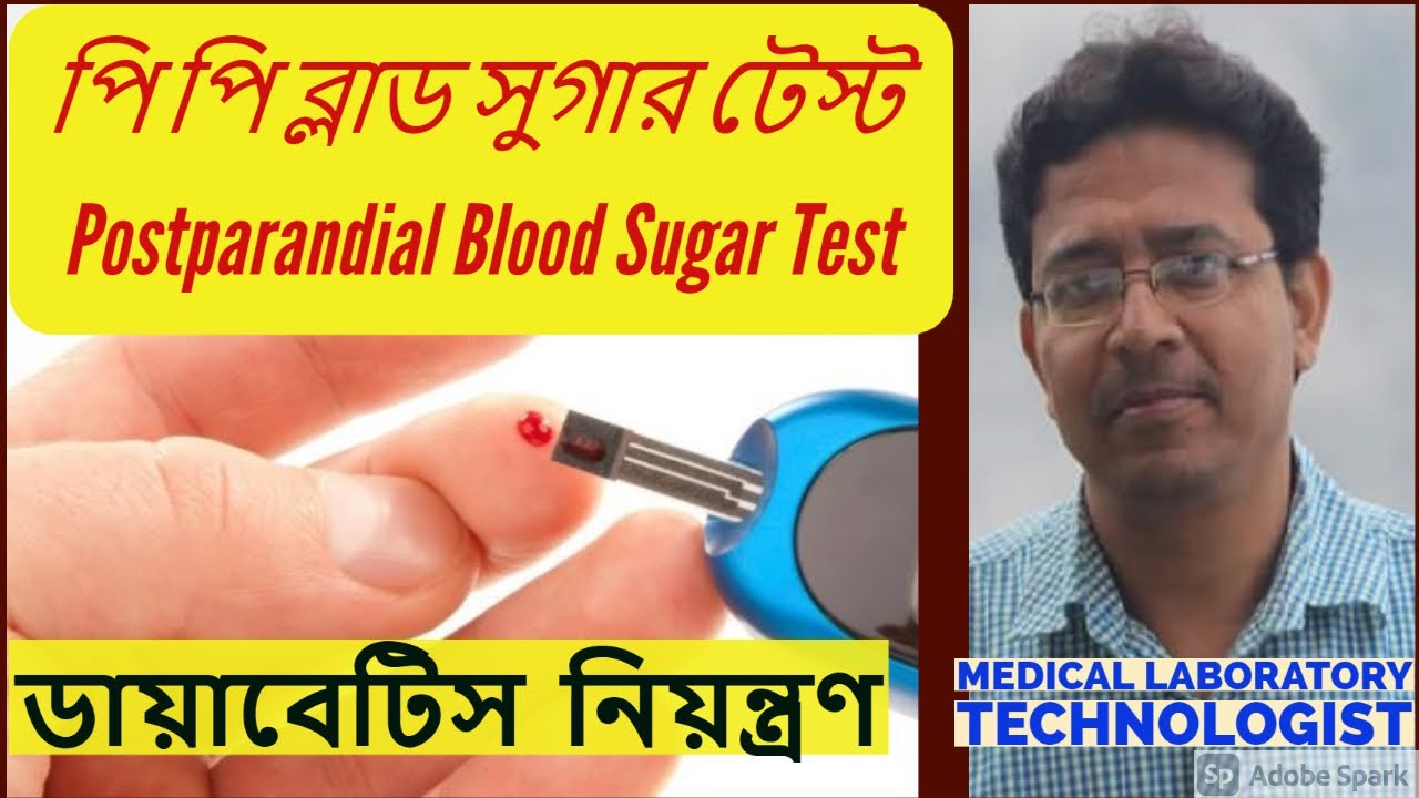 Postparandial Blood Sugar Test Postparandial Blood Sugar Test. PP Blood Sugar Test.