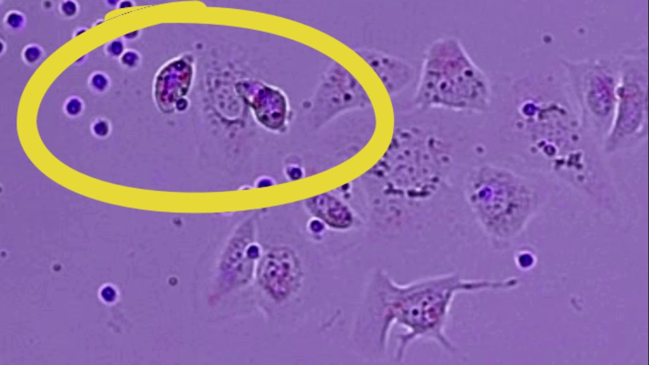 INKmune vs. Resting NK cells vs. IL-15 NK cells.