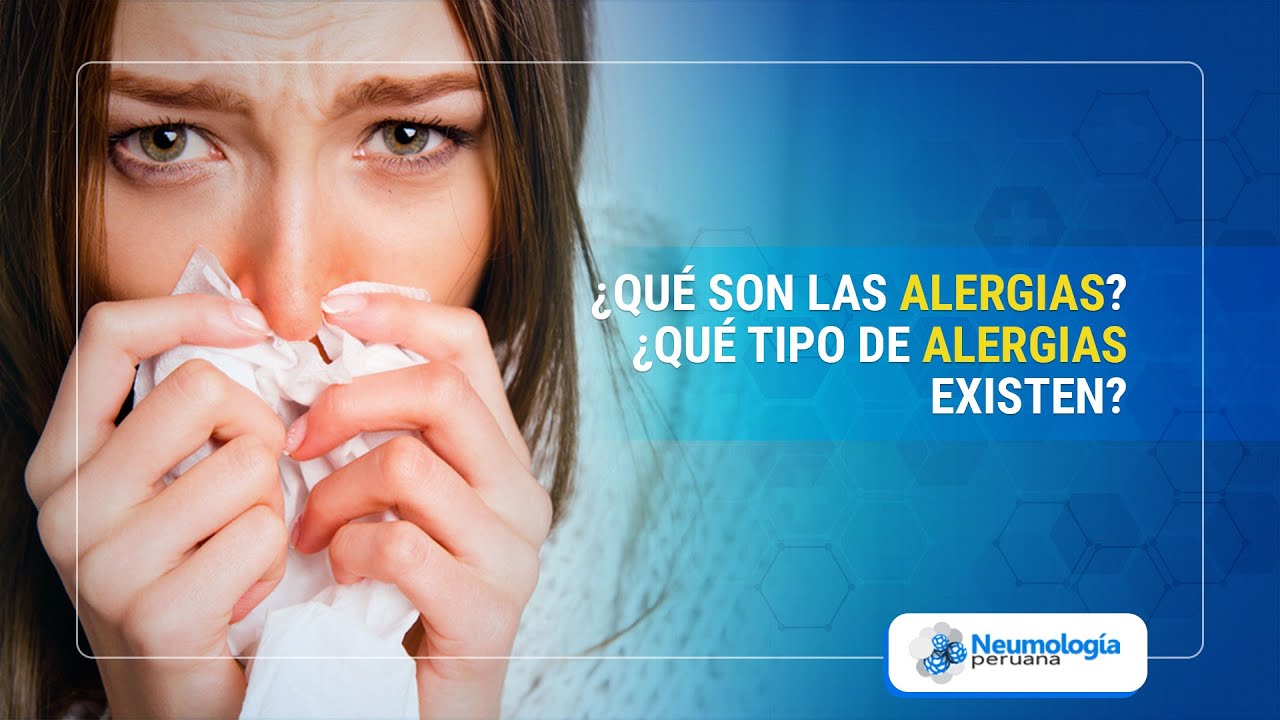 ¿Qué son las alergias ¿Qué tipo de alergias existen