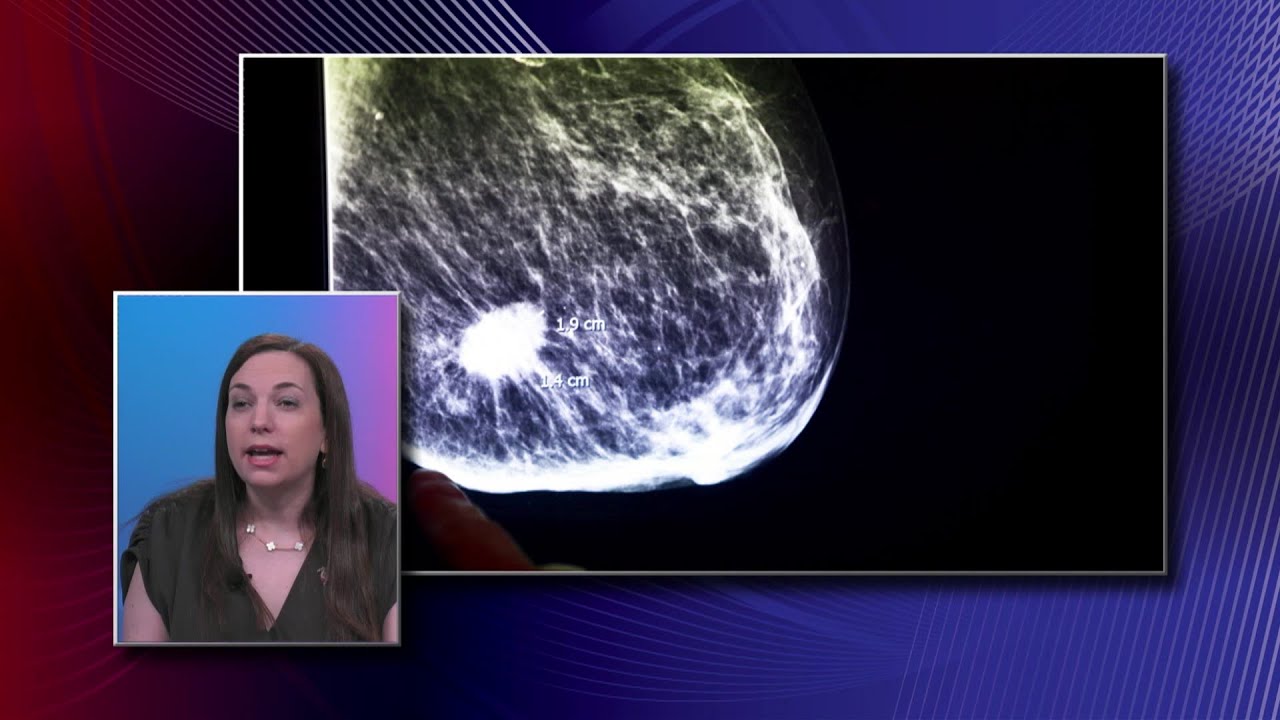 Mammogram Images