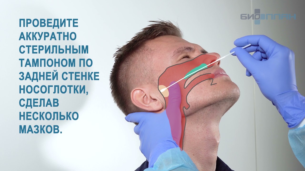 Видео инструкция Экспресс-тест NADAL® на антиген