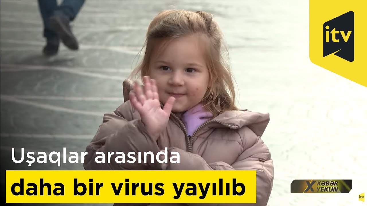 Uşaqlar arasında daha bir virus yayılıb
