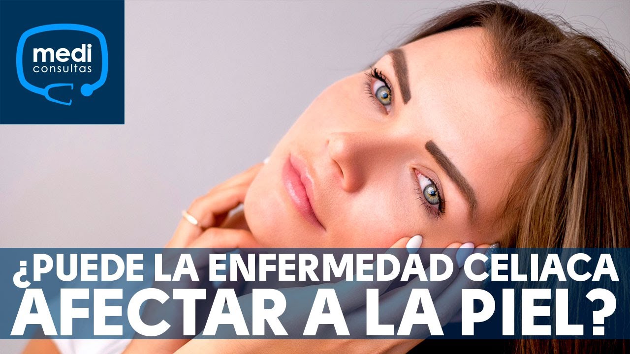 &iquest;Puede la enfermedad celiaca afectar a la piel? #MediConsulta
