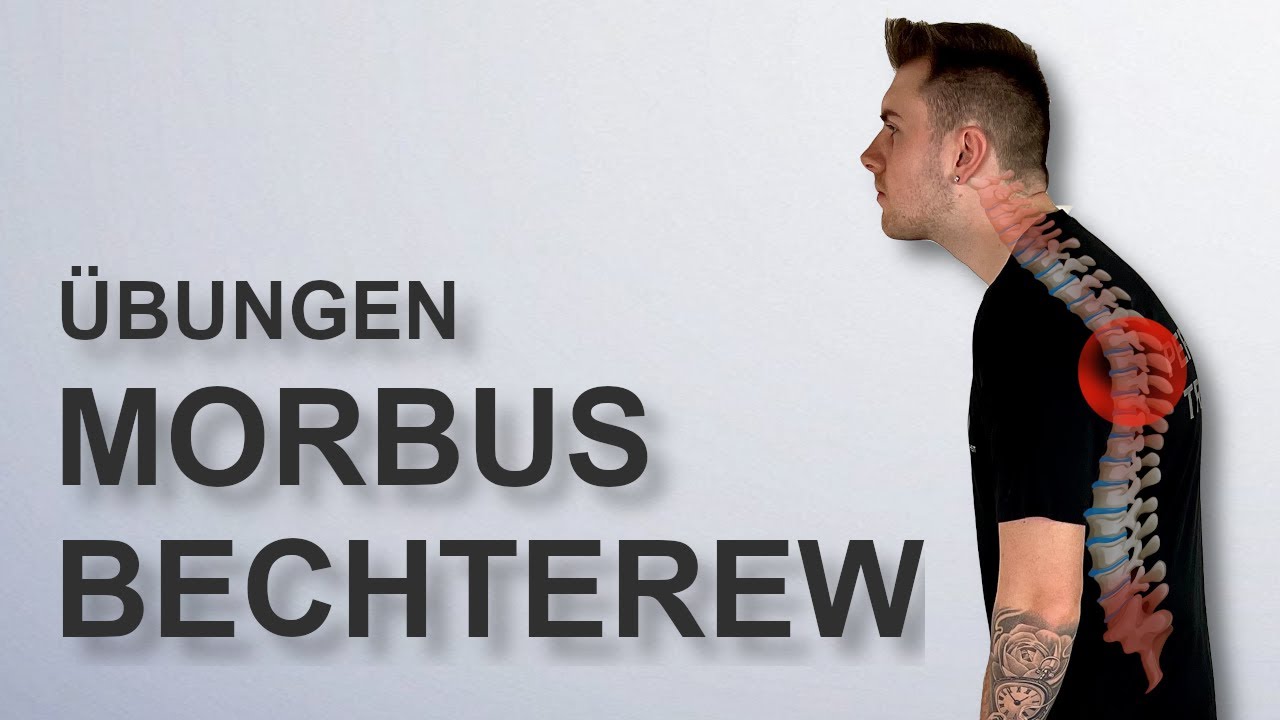 Morbus Bechterew | Übungen für zuhause