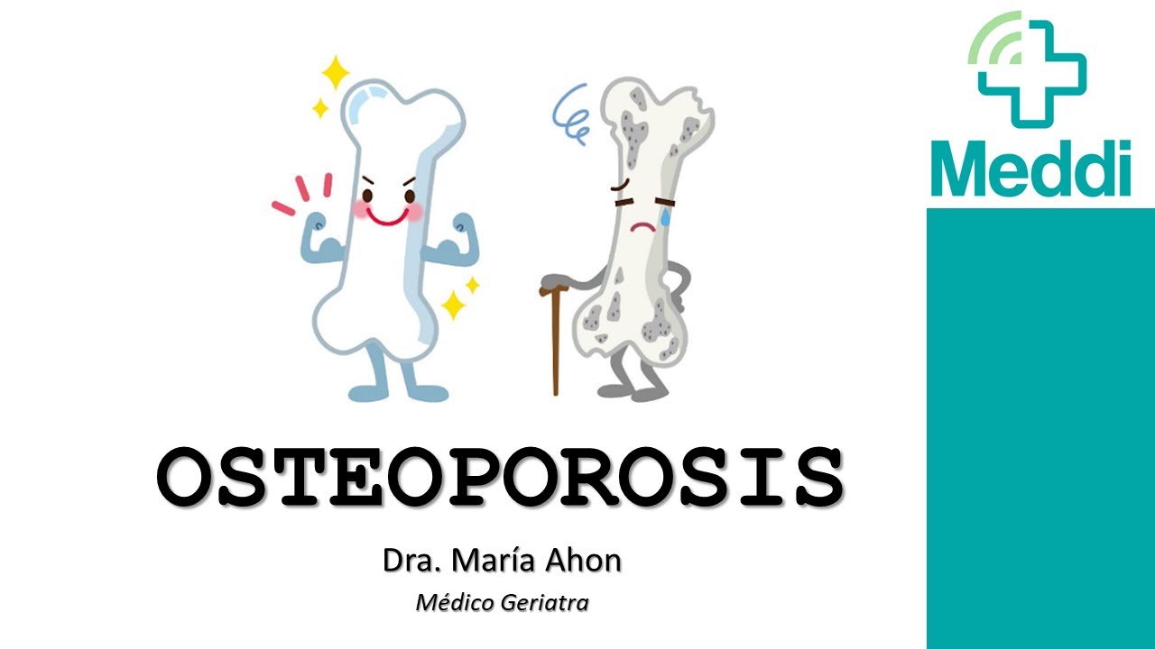 Osteoporosis en el Adulto Mayor. Diagnóstico y Tratamiento