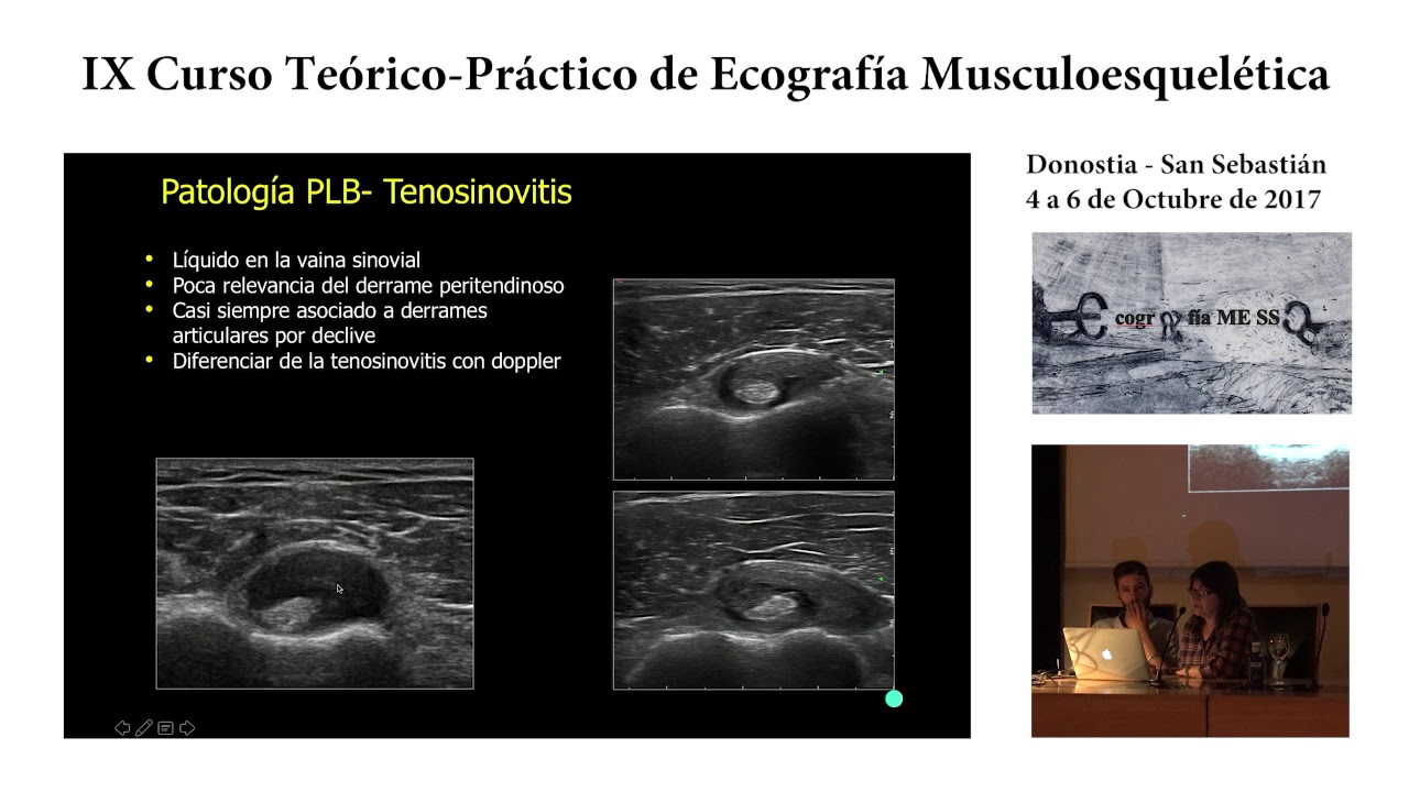 la ecografia en la patologia del tendon del biceps