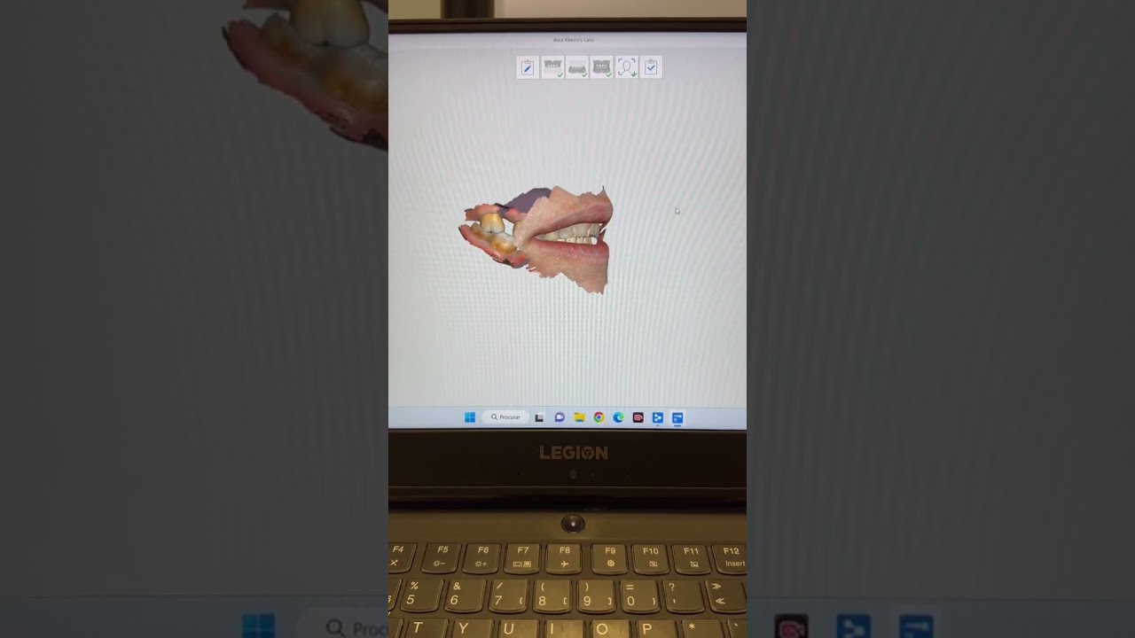 Intraoral scan and facial scan Medit i500 