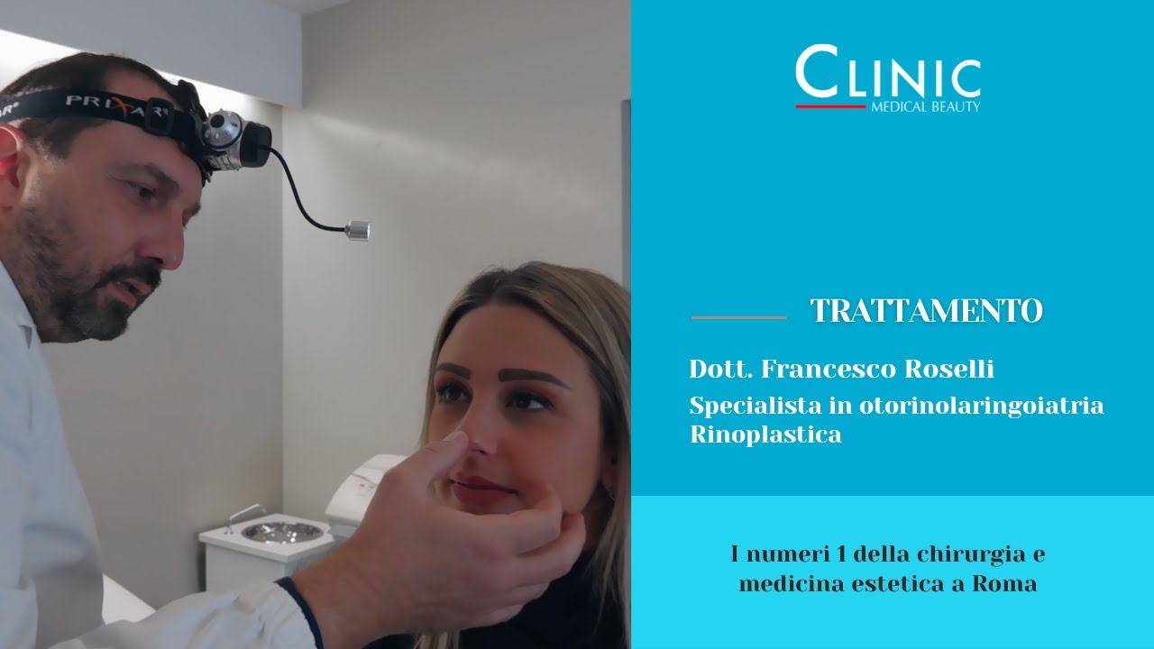 Rinoplastica, consulto pre operatorio - Dott. Francesco Roselli | Clinic Medical Beauty