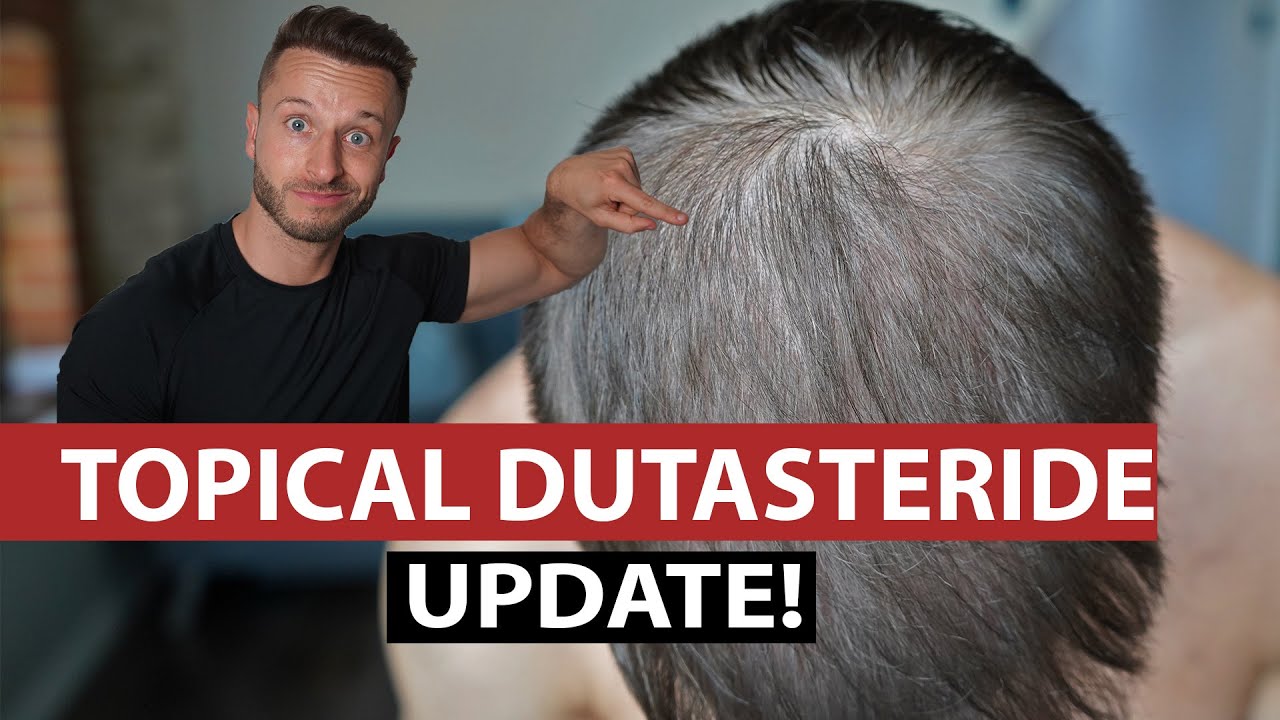 TOPICAL DUTASTERIDE UPDATE! 2021